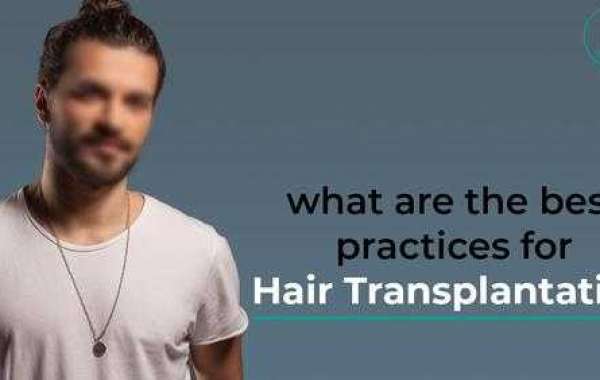 Hair Loss Treatment in Delhi - Hairsmith