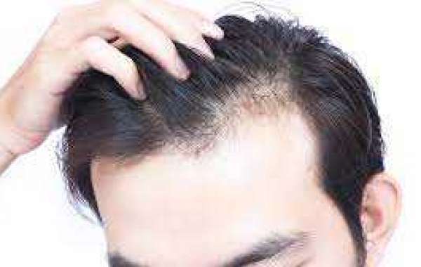 Can stress cause thinning hair